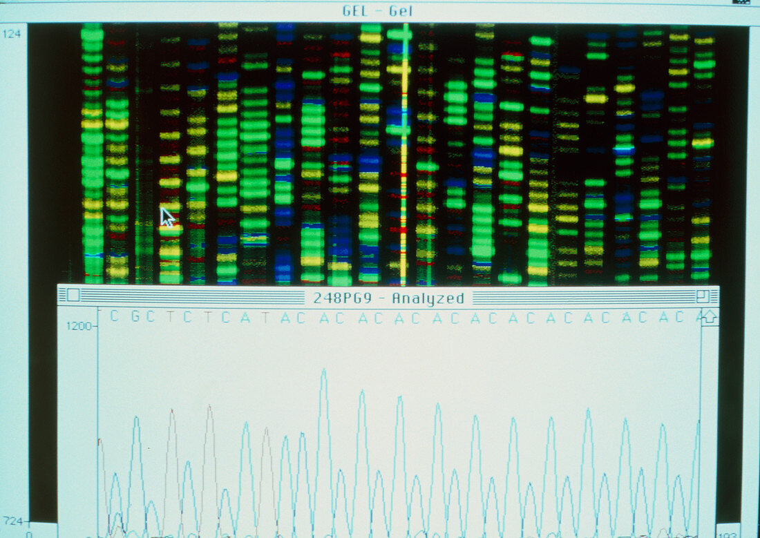 Human genome research: automated DNA sequencing