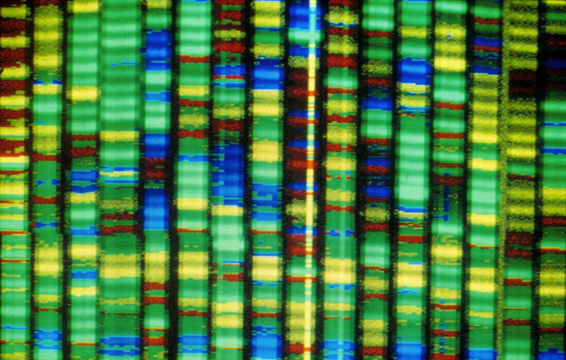 Human genome research: computer DNA sequencing
