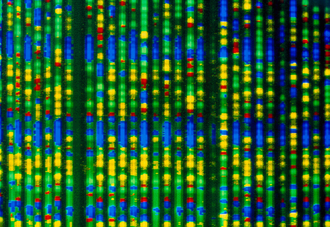 Genome research: autoradiogram of sequenced cDNA