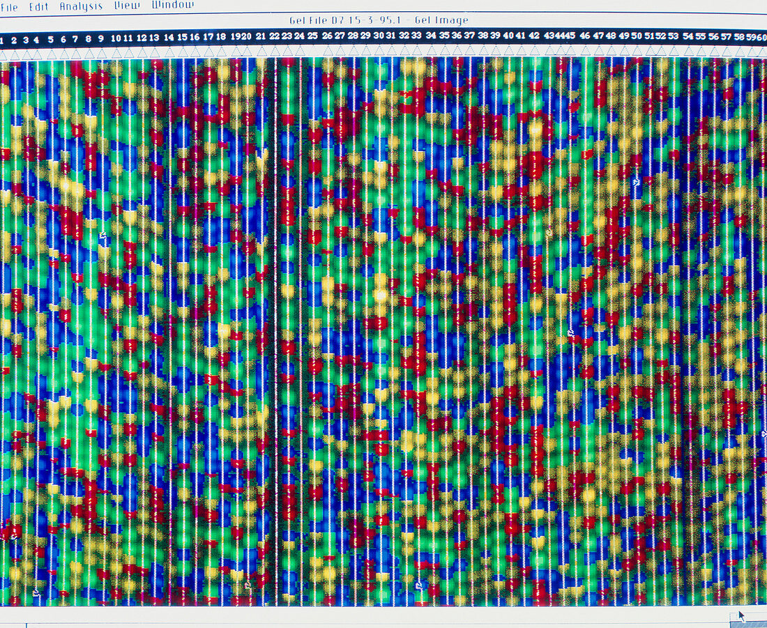 Computer screen display of DNA sequencing pattern
