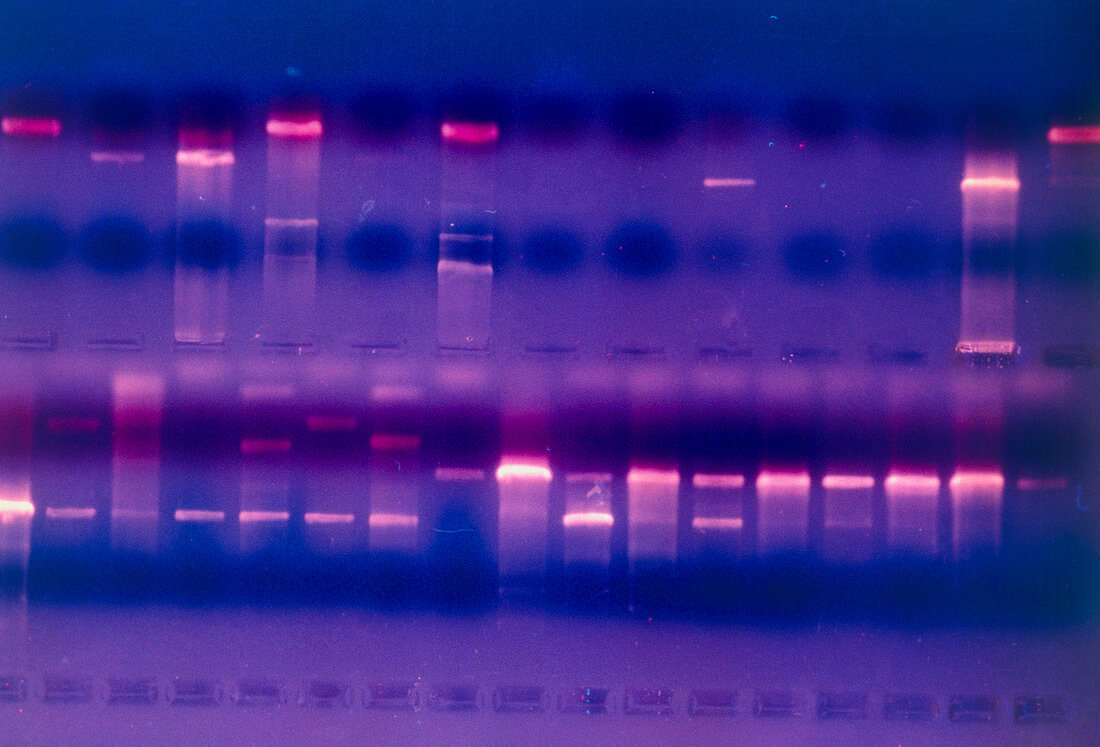 DNA fragments in gel stained with Ethidium Bromide