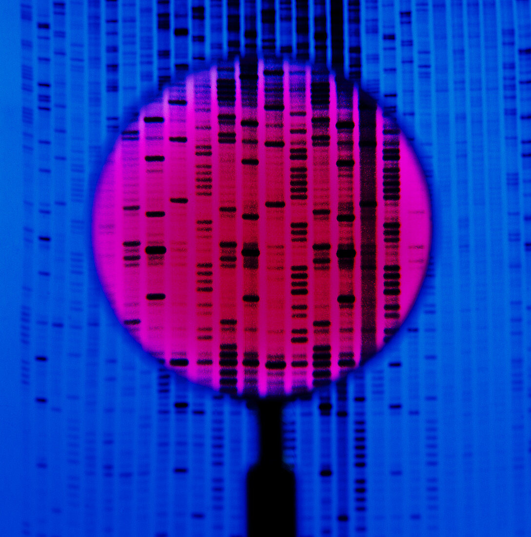 DNA autoradiogram