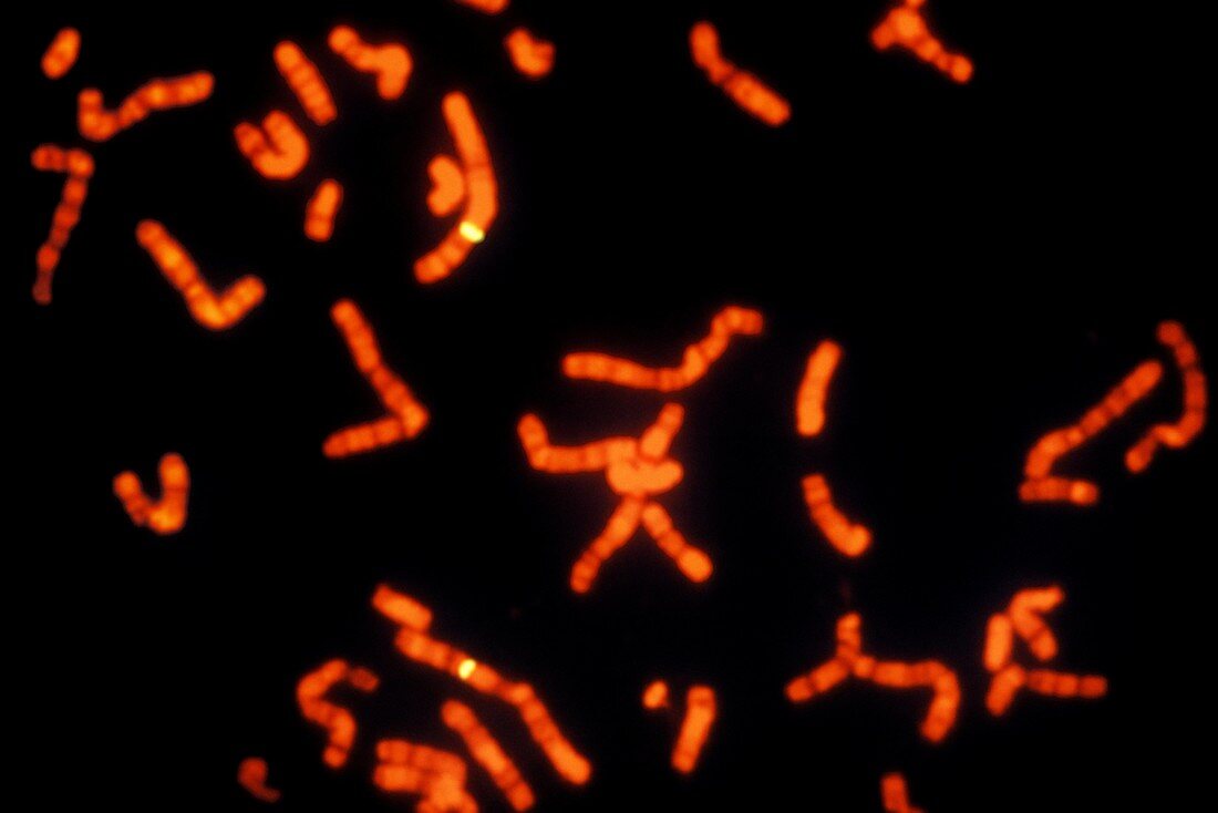 FISH micrograph of chromosomes