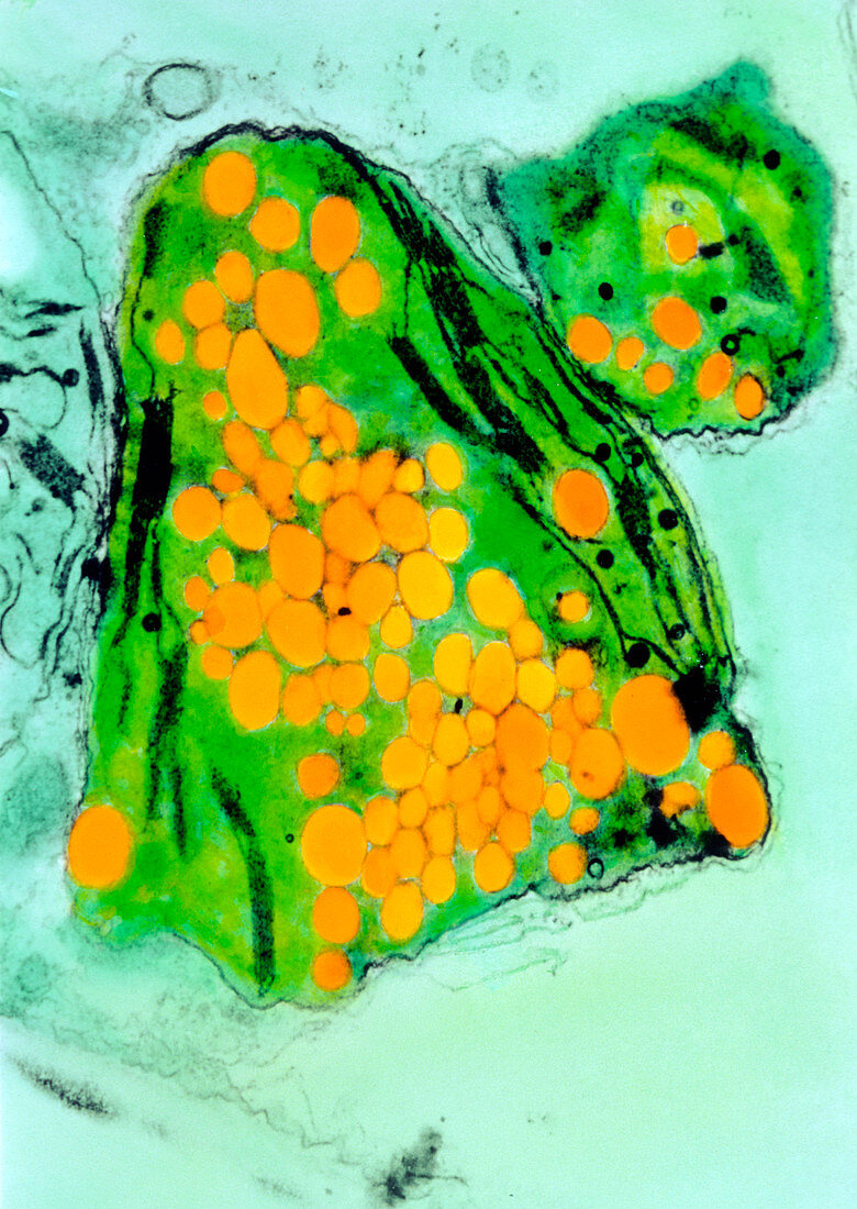 TEM of cress chloroplast growing plastic