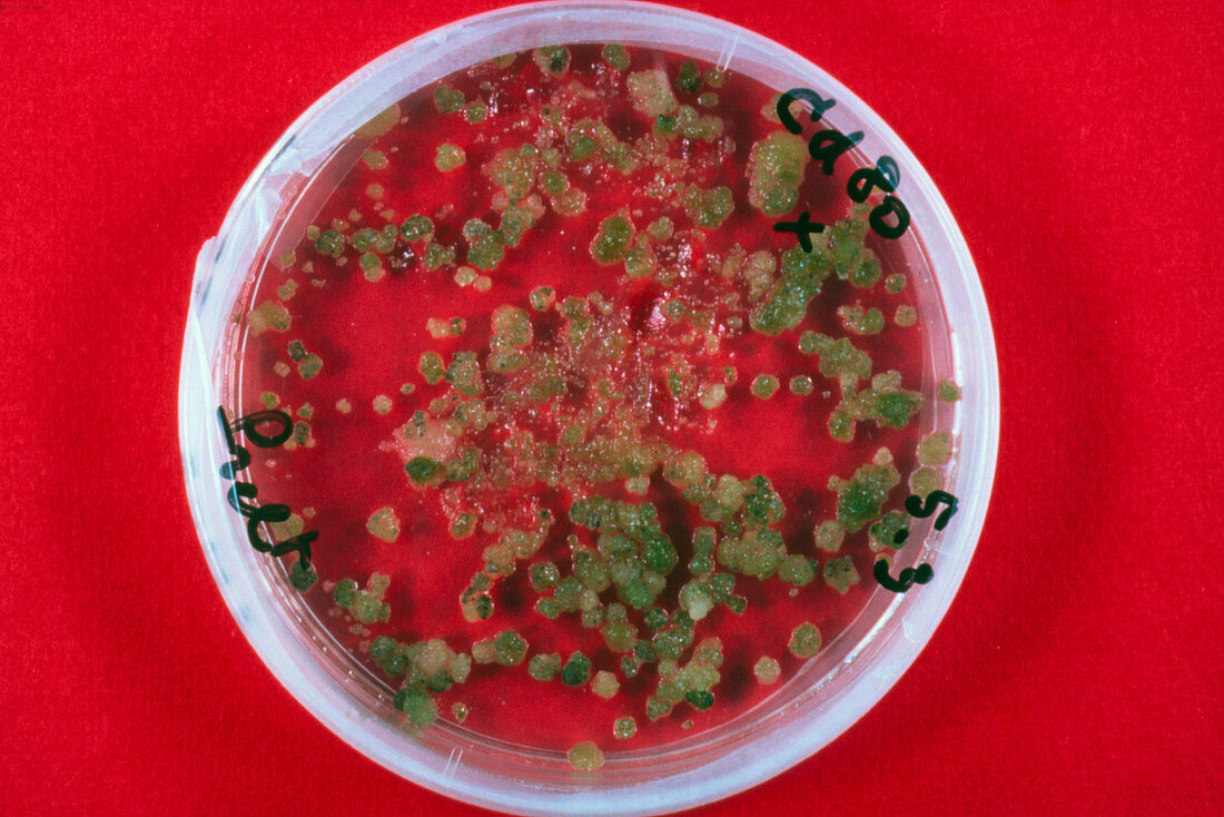 Petri dish containing plant callus tissue culture