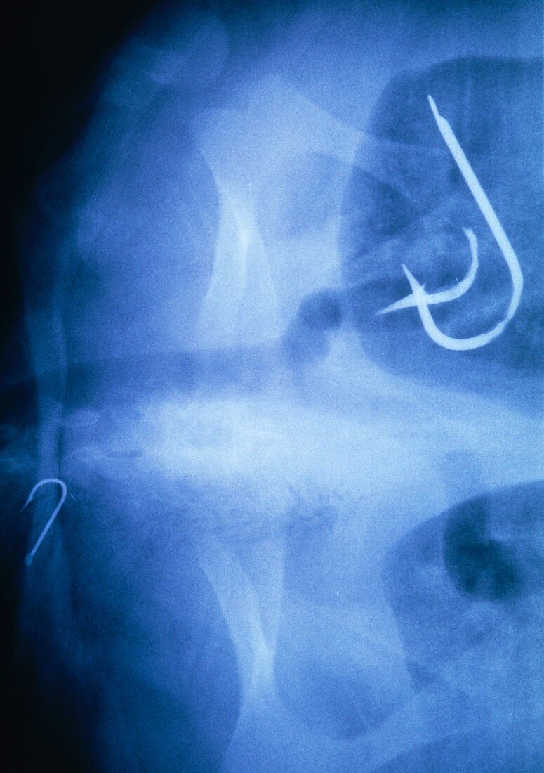 X-ray of a turtle showing swallowed fish hooks