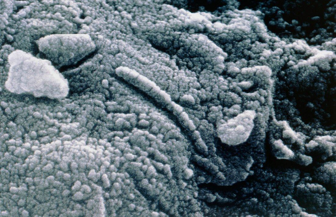Electron micrograph of Martian microfossil