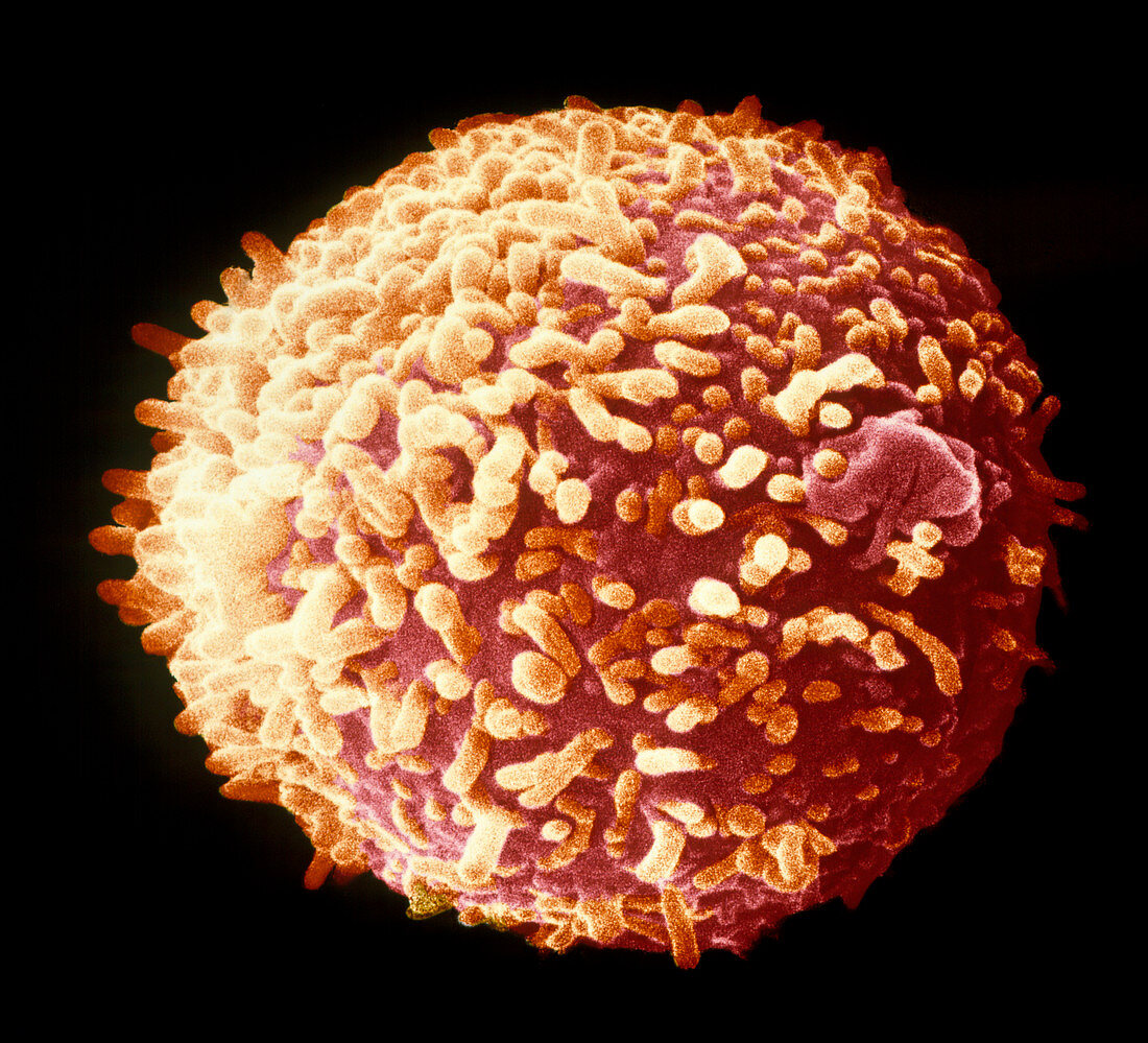 False-colour SEM of a Hybridoma cell