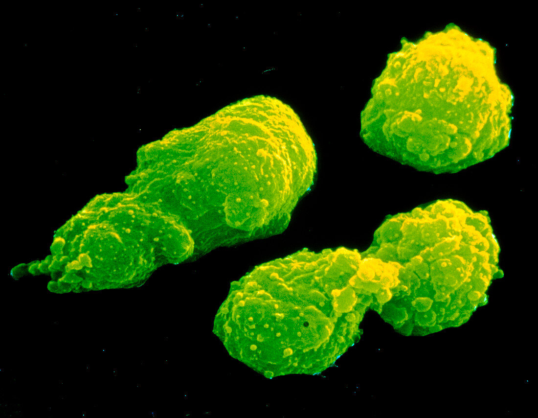 SEM of hybridoma cells used in cancer therapy
