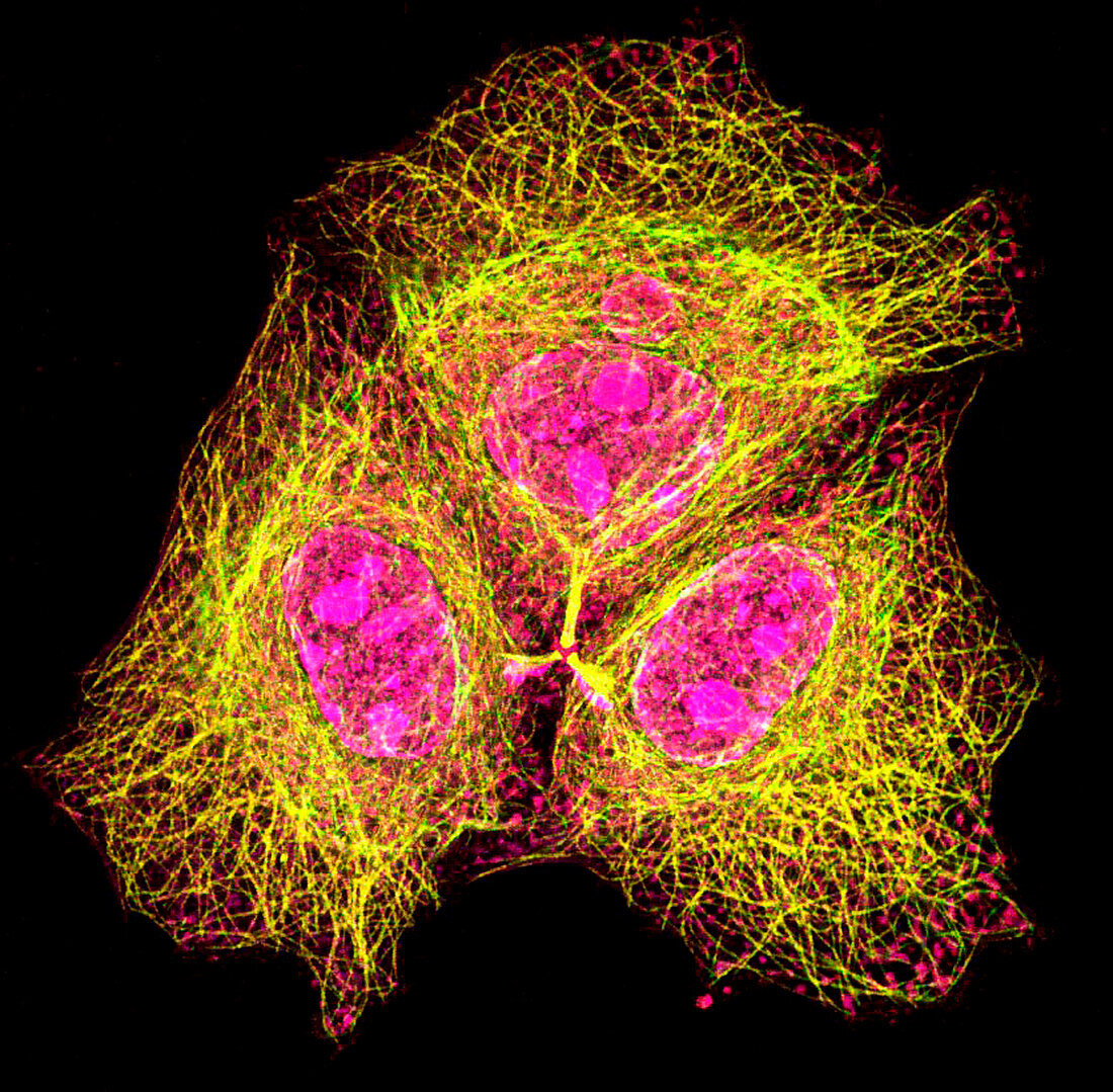 HeLa cells,light micrograph