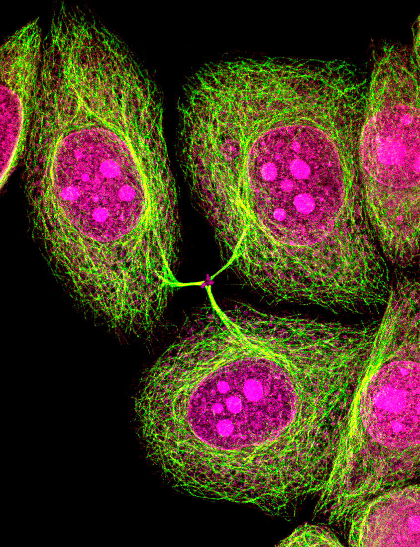 HeLa cells,light micrograph