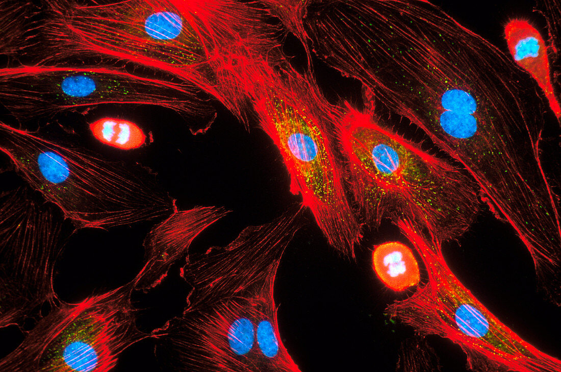 Human endothelial cells,light micrograph