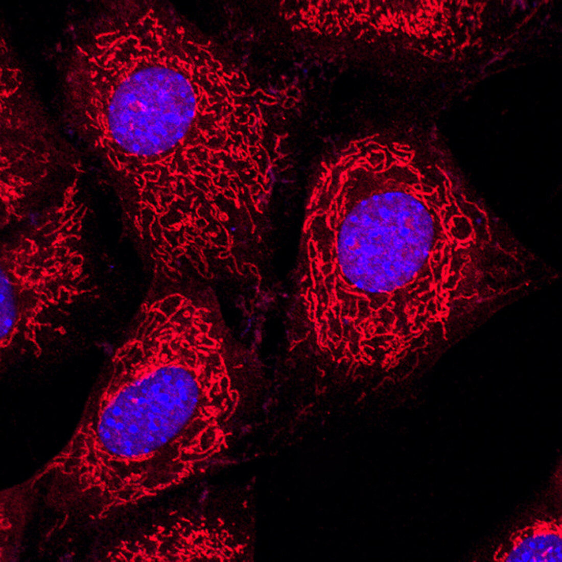 HeLa cells,light micrograph