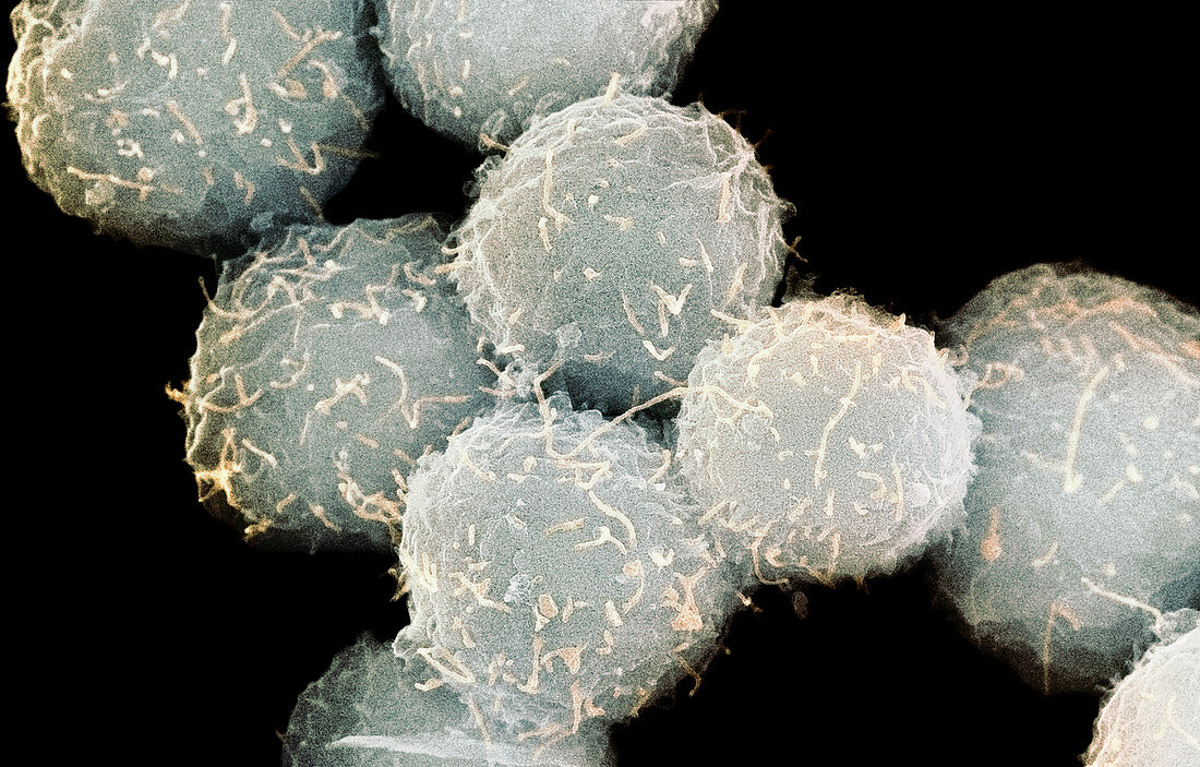 Stem cells,SEM