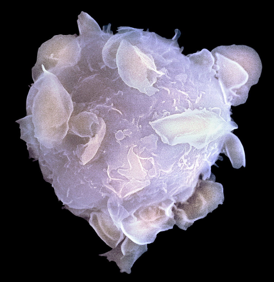 Bone marrow stem cell,SEM