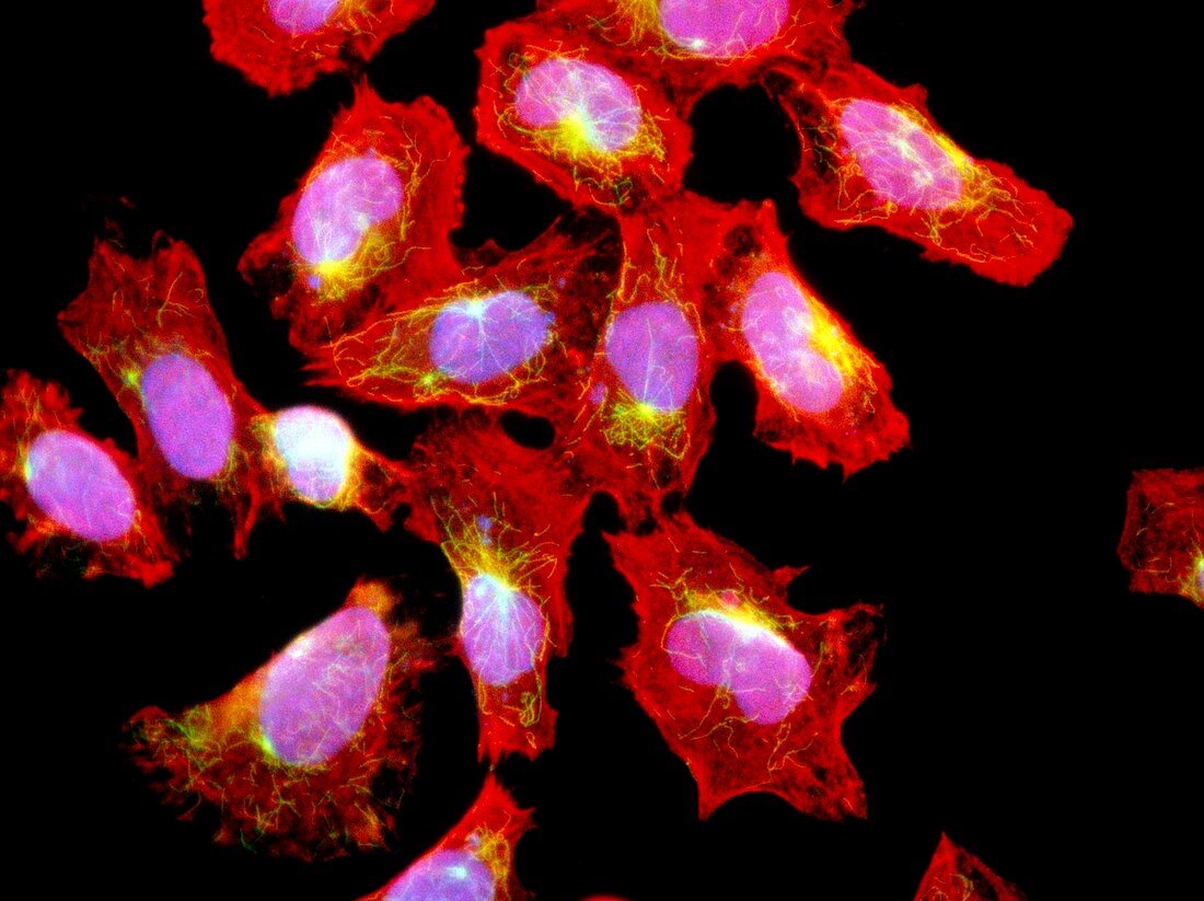 Immunofluorescent LM of HeLa cancer cells