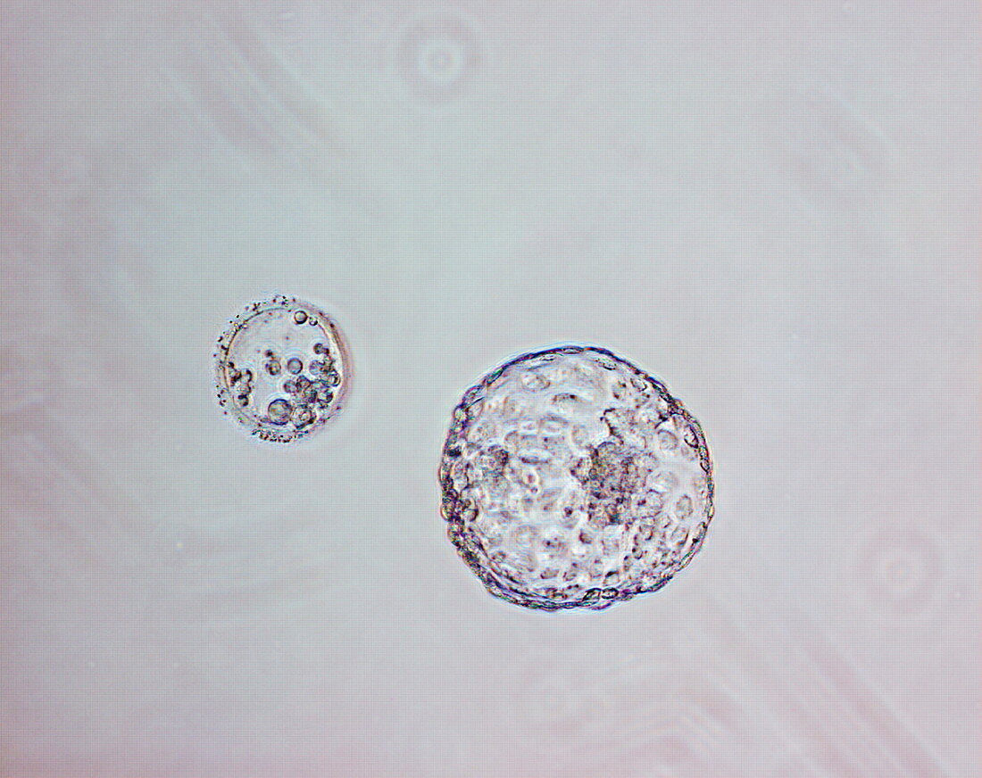 Human blastocyst,light micrograph