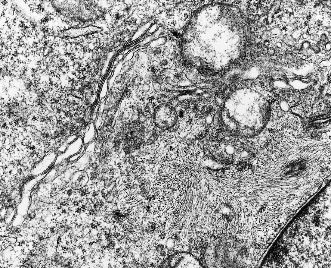 TEM of golgi body and mitochondria of HeLa cell