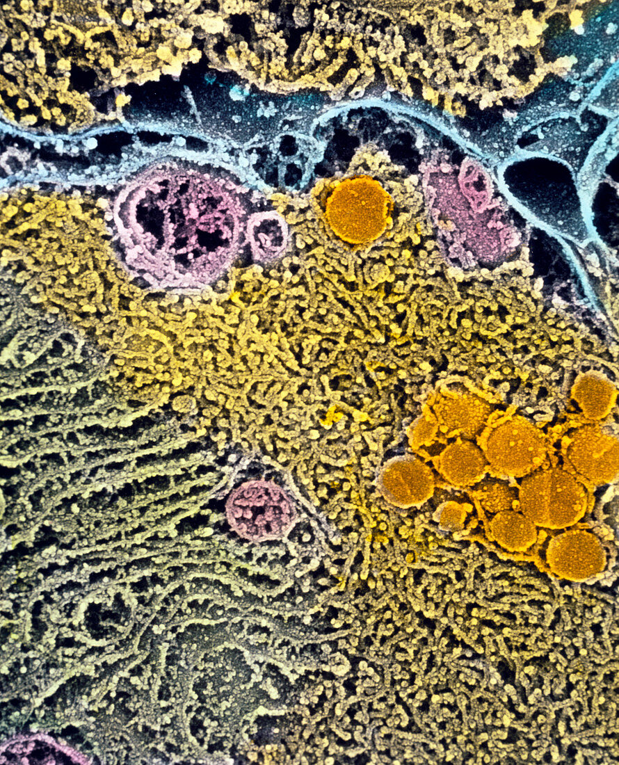 Colour SEM of endoplasmic reticulum in Leydig cell