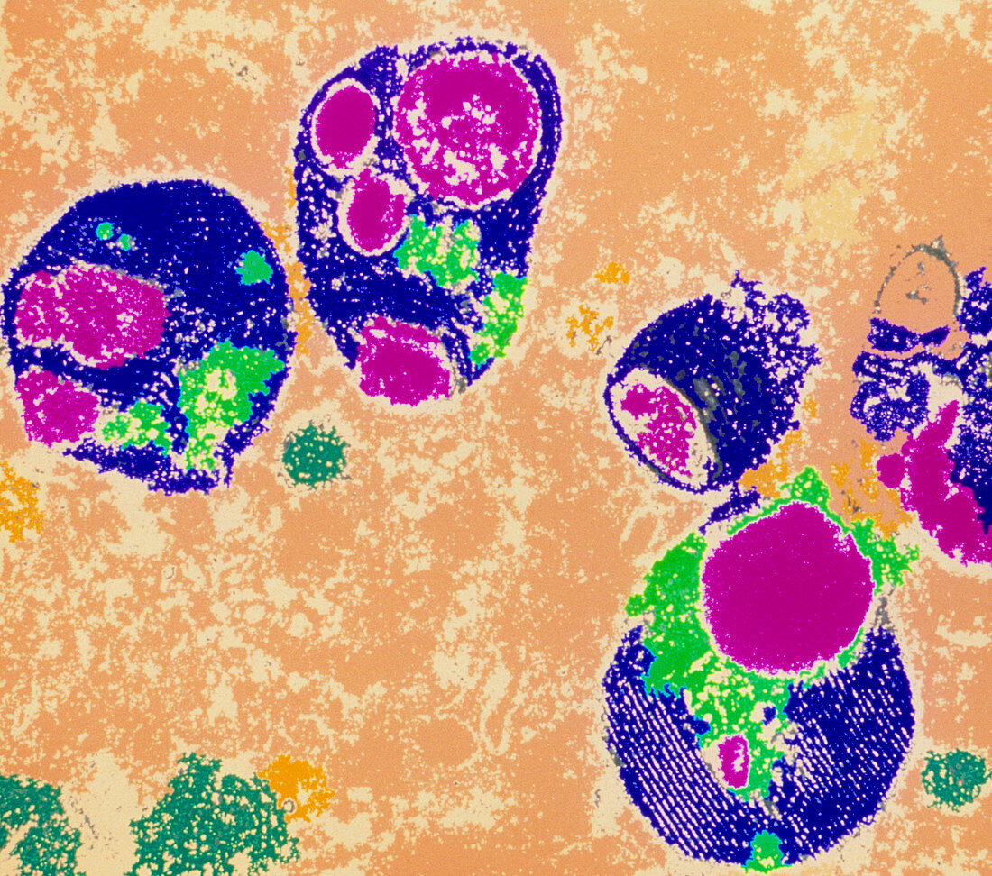 Coloured TEM of mammalian lysosomes