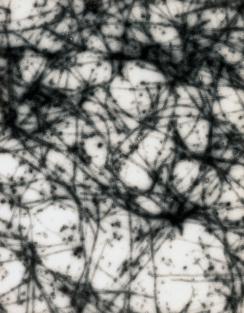 Transmission electron micrograph of microtubules