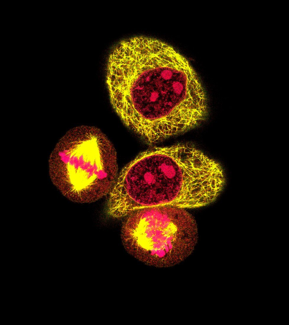HeLa cells in mitosis,light micrograph