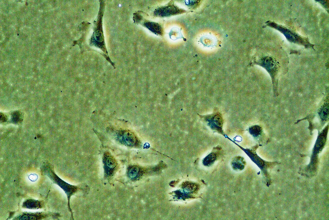 Endothelial stem cells,light micrograph