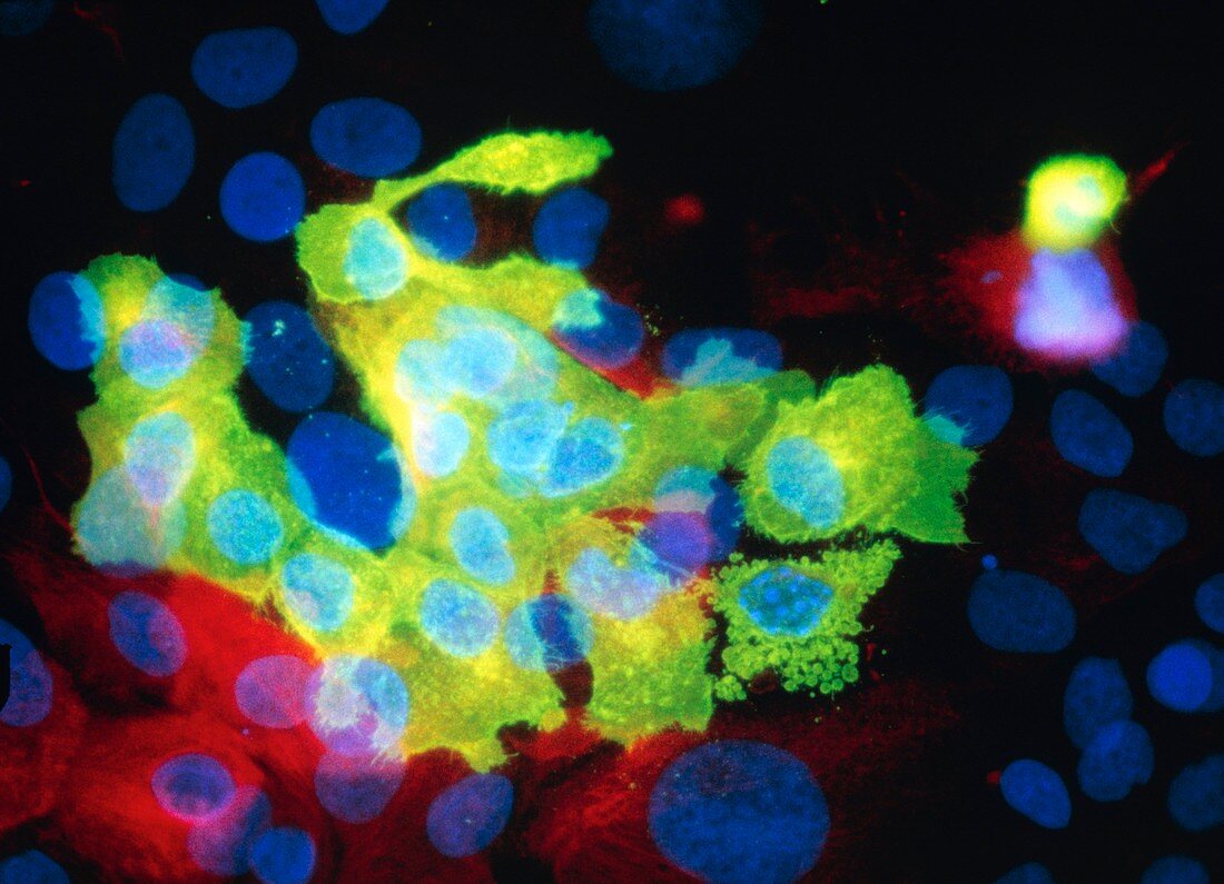 Immunfluorescent LM of cell death (apoptosis)