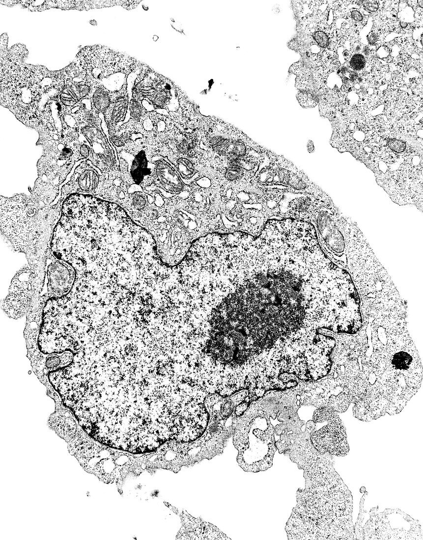 Transmission electron micrograph of animal cell