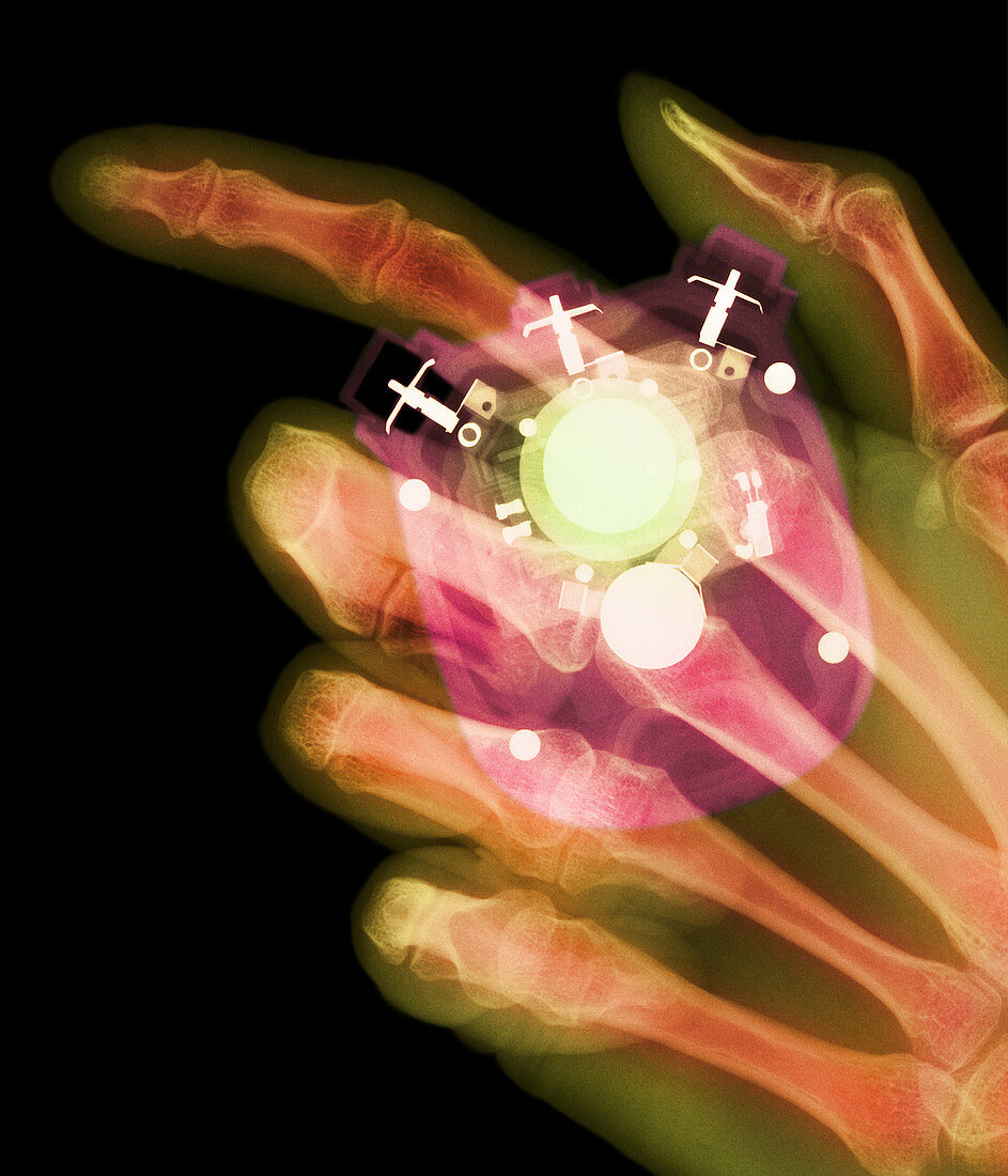 Coloured X-ray of a stopwatch held in a hand