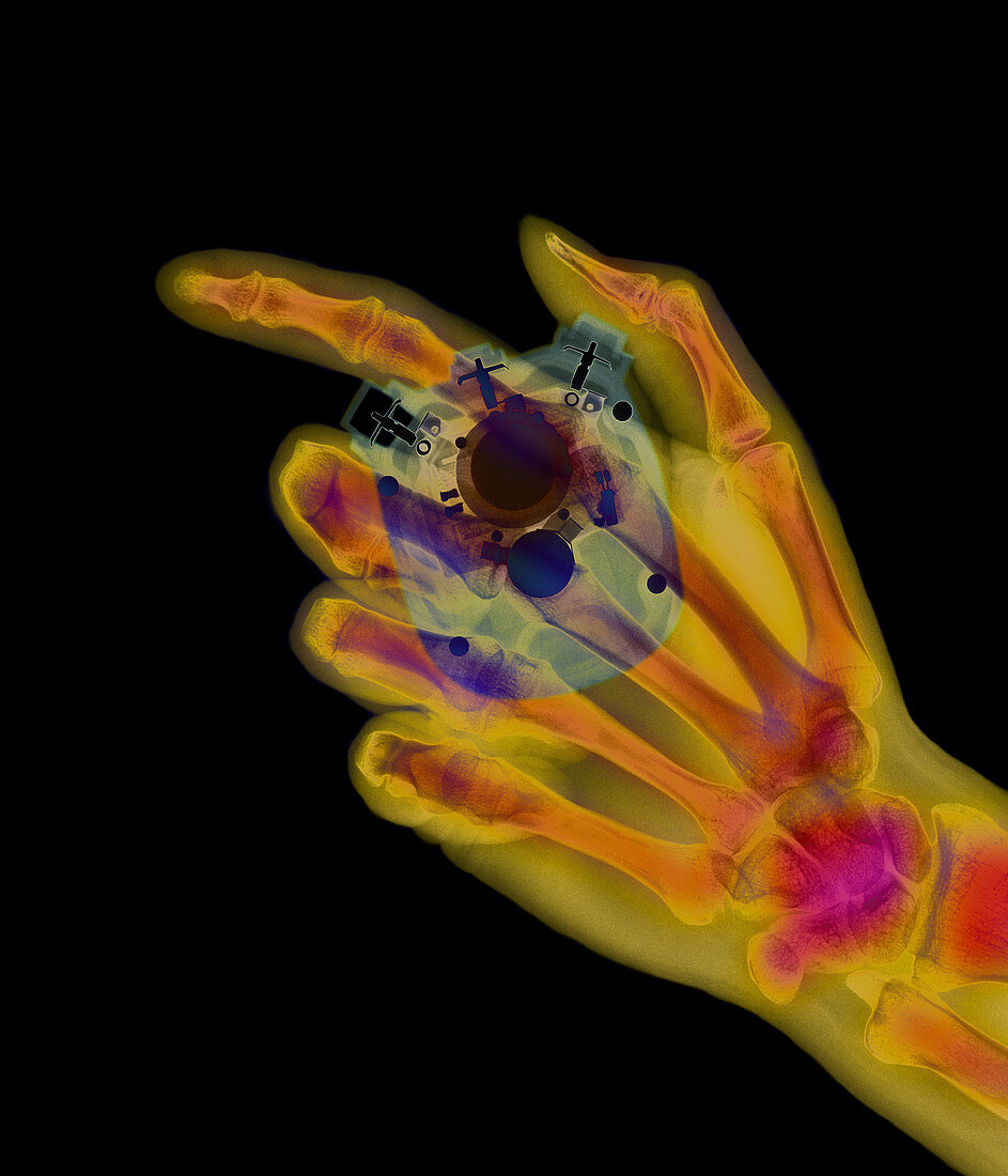 Coloured X-ray of a stopwatch held in a hand