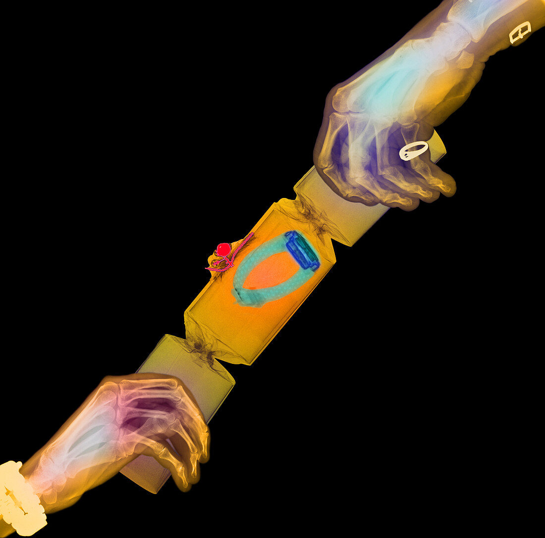 Coloured X-ray of hands pulling a party cracker