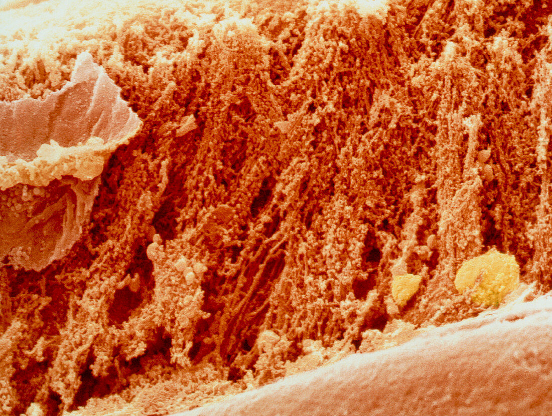 Coloured SEM of section through well-cooked meat