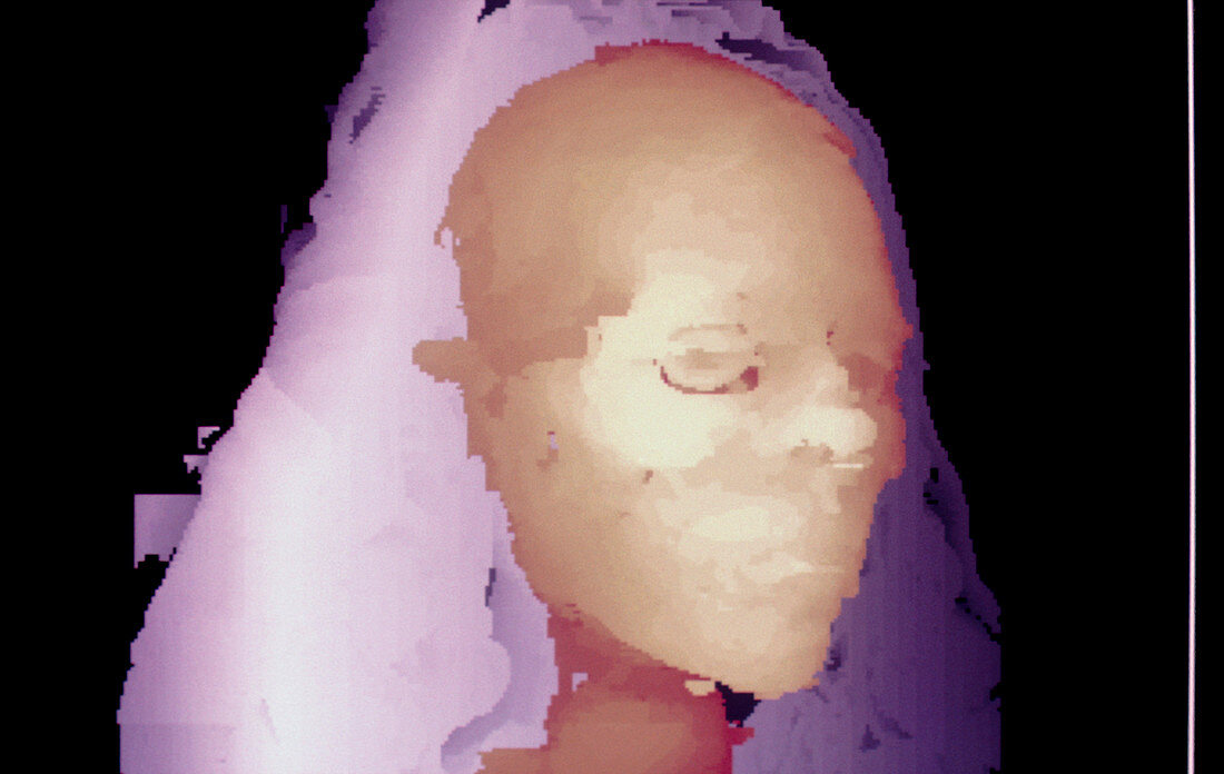 3-D CT scan of mummy head