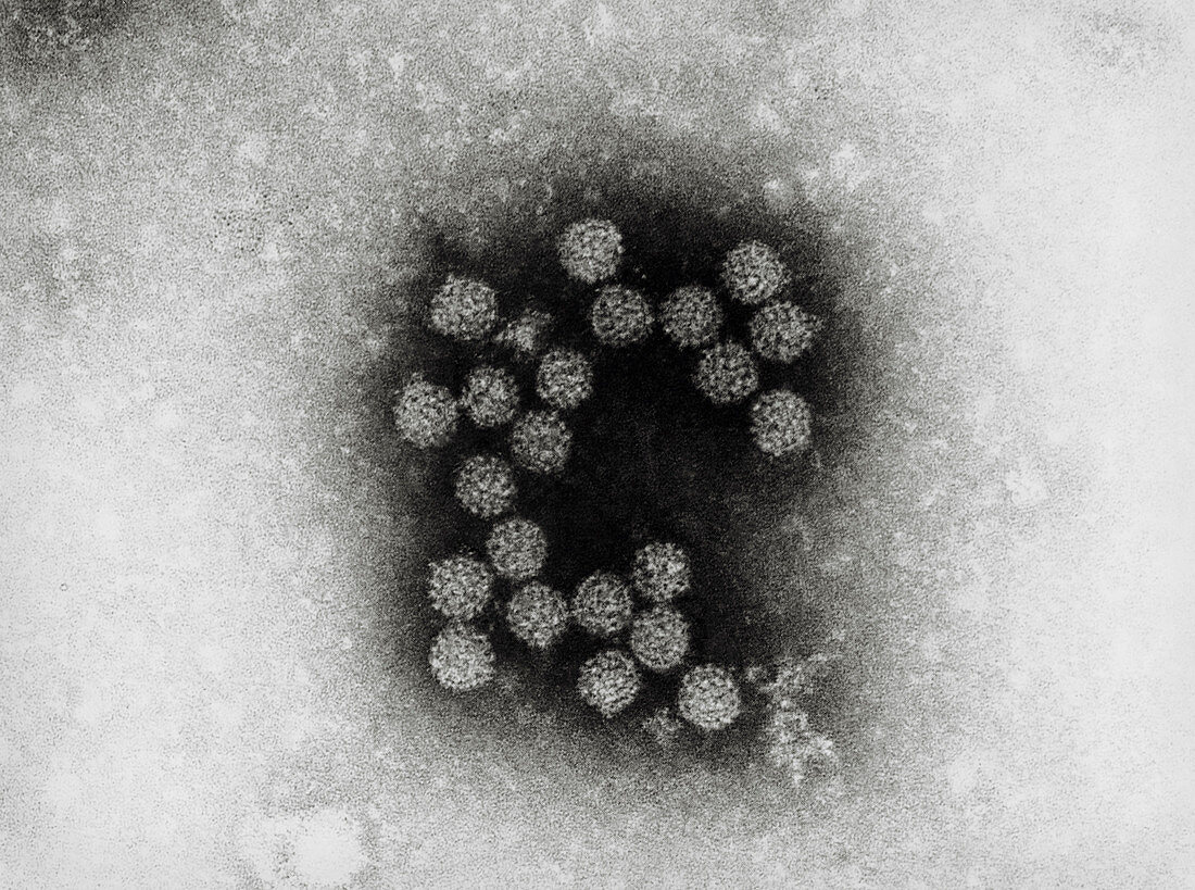 TEM of papillomavirus (wart virus)