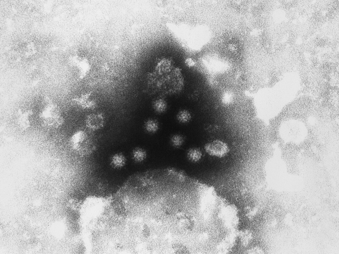 TEM of Norwalk virus