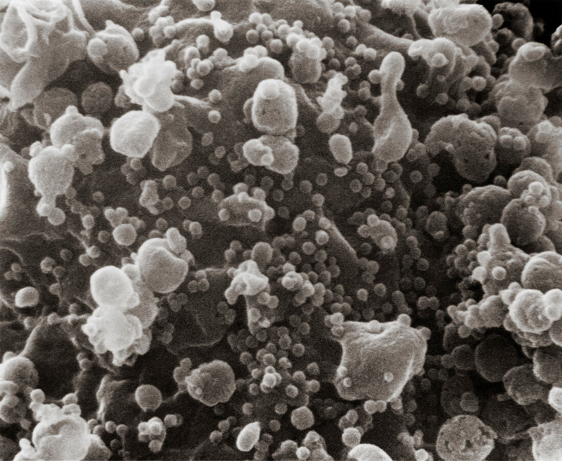 SEM of T-cell surface infected with AIDS virus