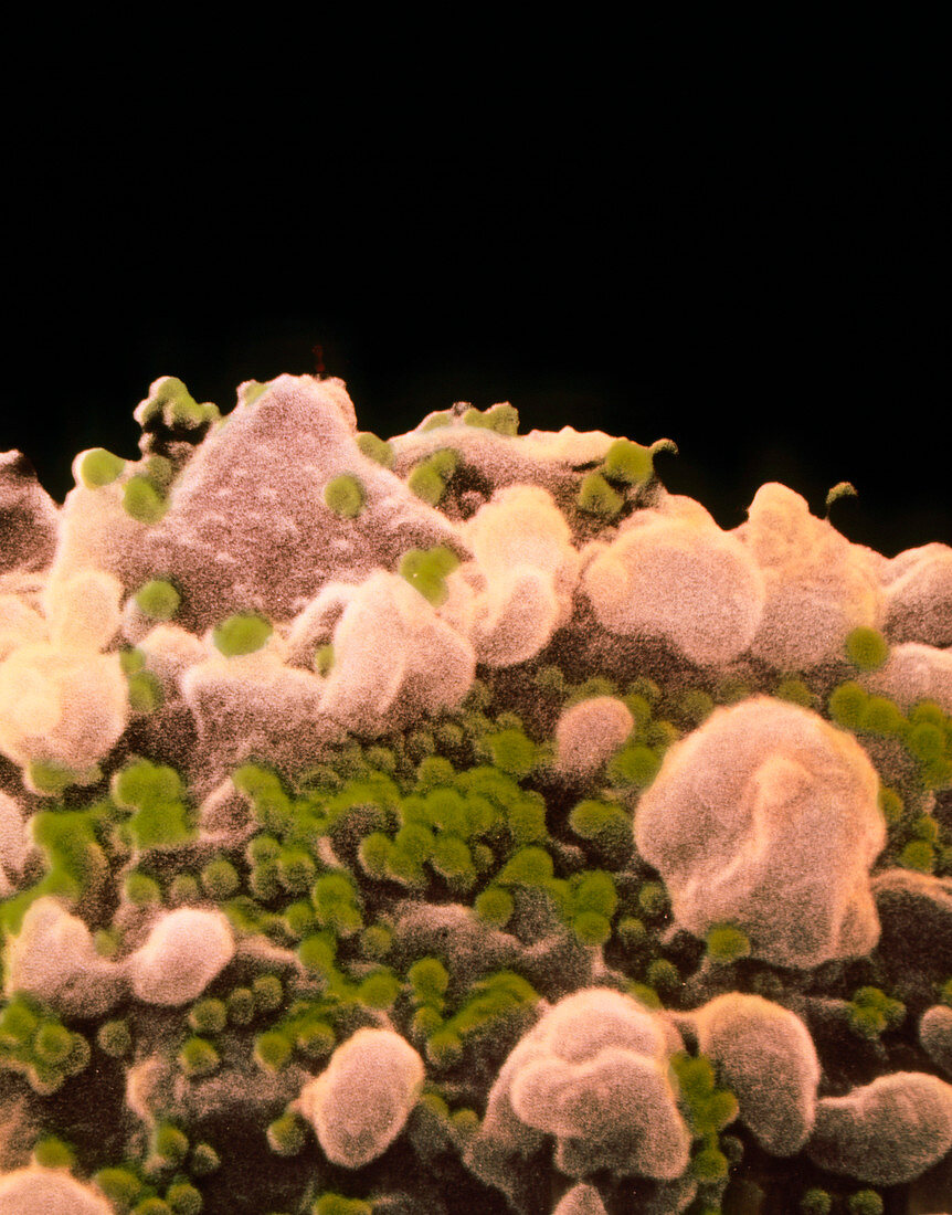 False-col SEM of T-lymphocyte infected with HIV