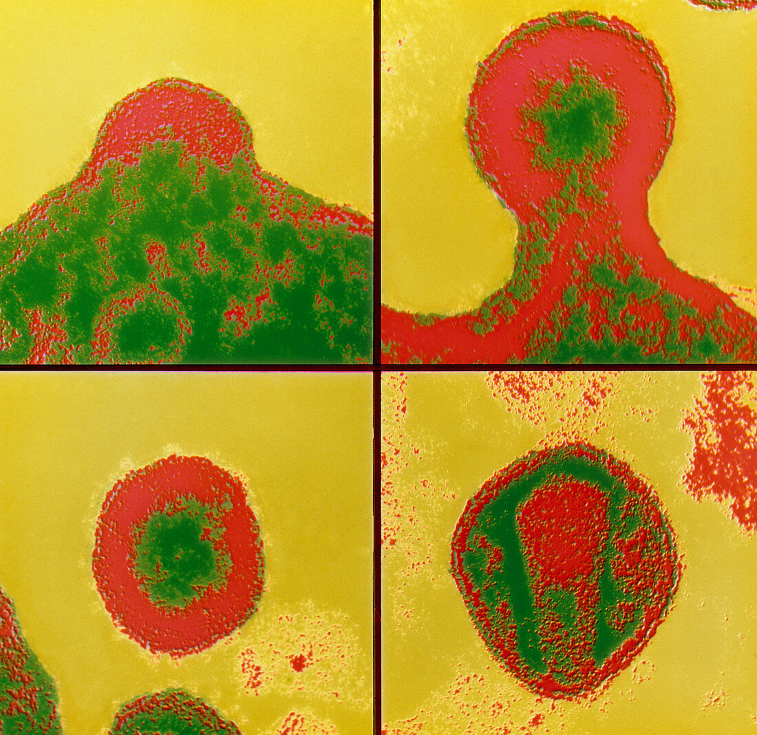 Fal-col TEM sequence of budding Aids virus