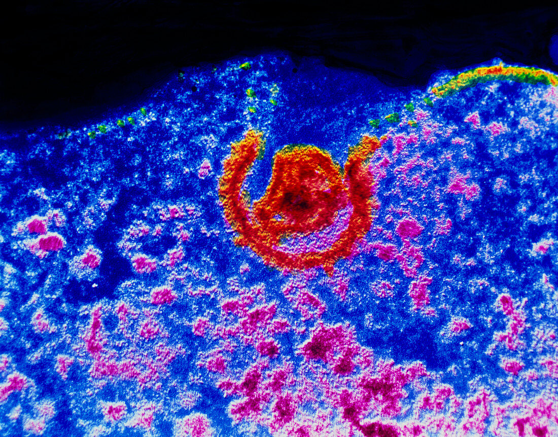 TEM of an HIV virion entering a lymphocyt
