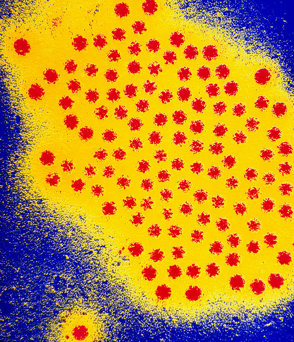 Coloured TEM of a group of astroviruses
