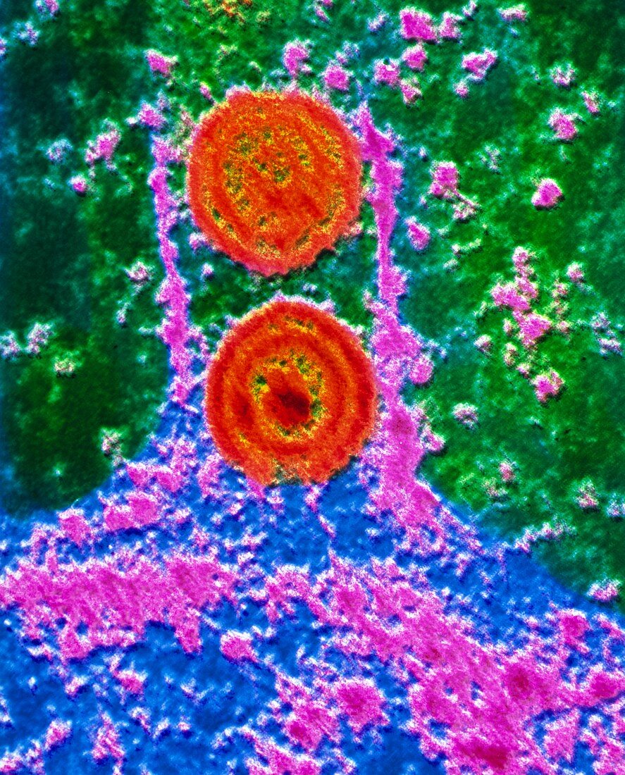 False-colour TEM of herpes simplex virus