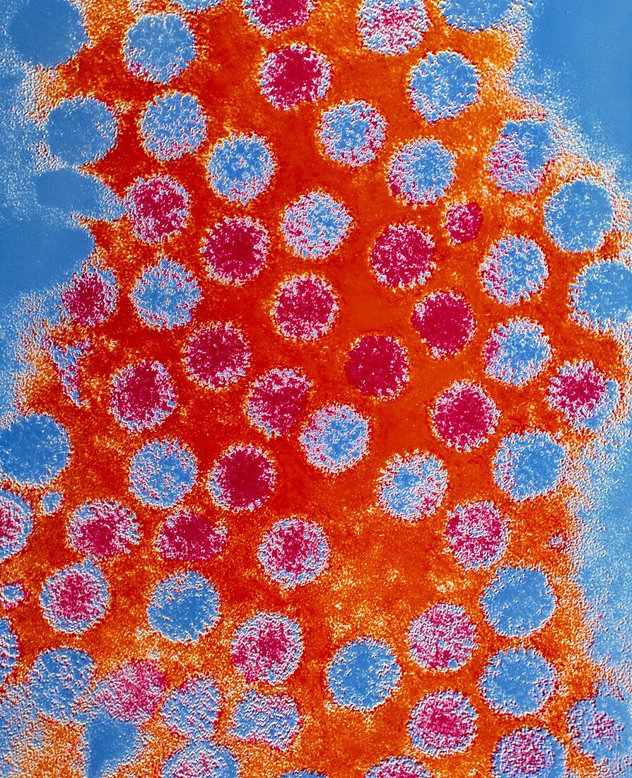 Coloured TEM of rotaviruses