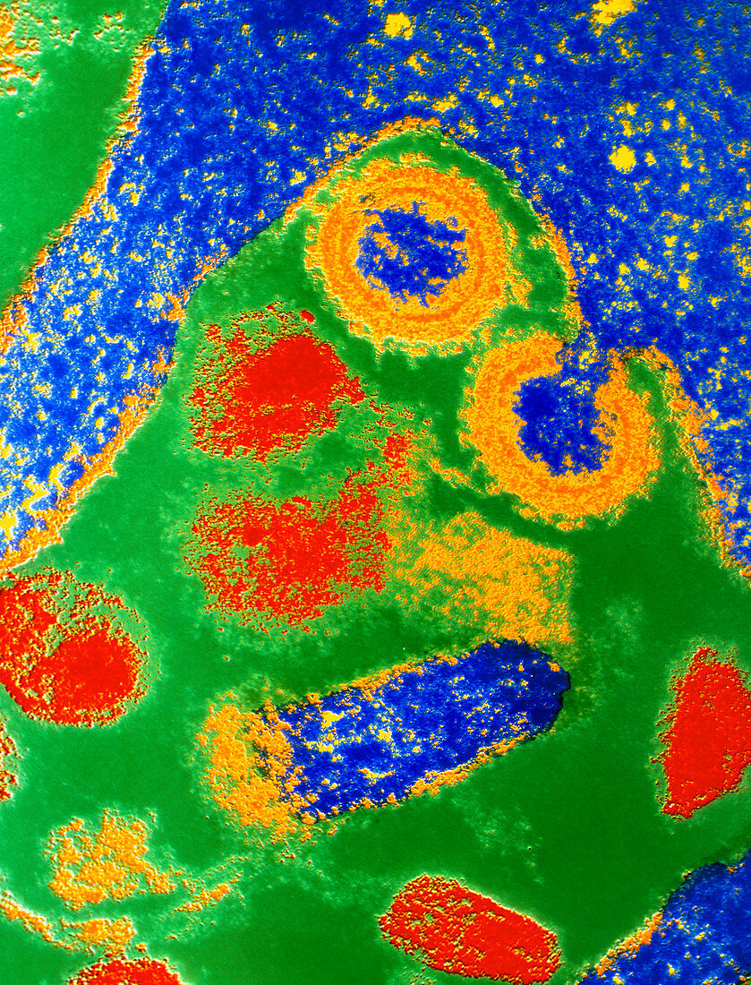 Coloured TEM of SIV virus particles