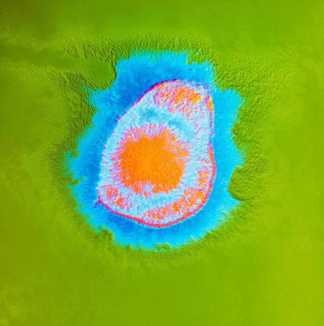 Coloured TEM of Herpes simplex virus