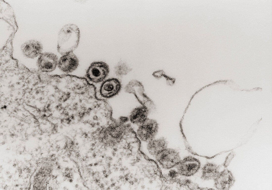 TEM of HIV (AIDS) viruses budding from a T-cell