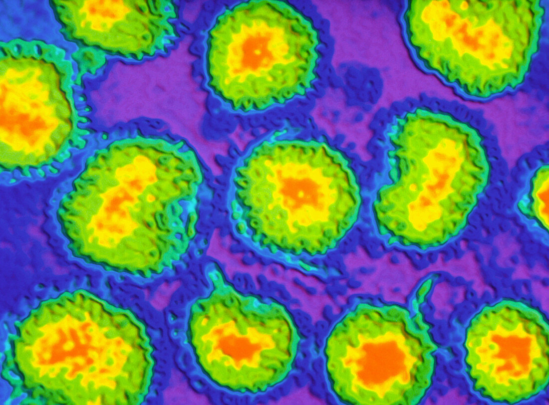 Coloured TEM of a group of bunyaviruses