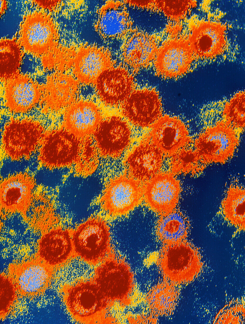 Coloured TEM of Epstein-Barr virus