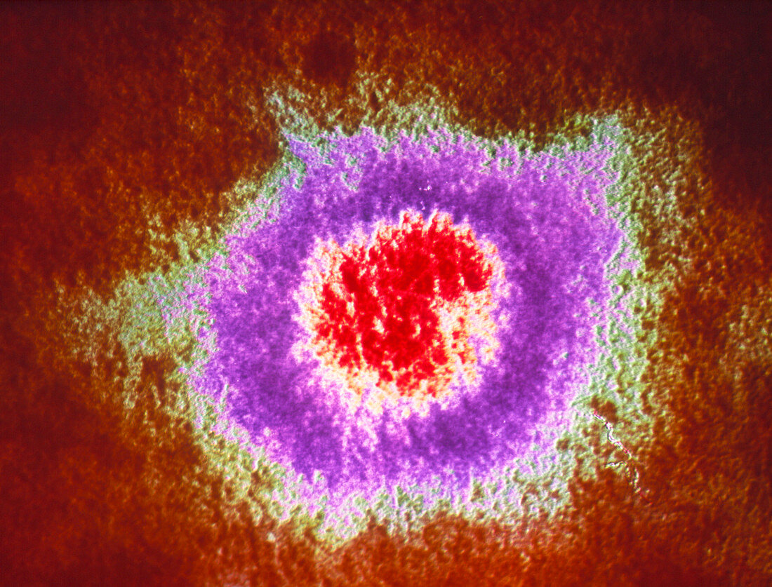Coloured TEM of the Herpes Simplex virus