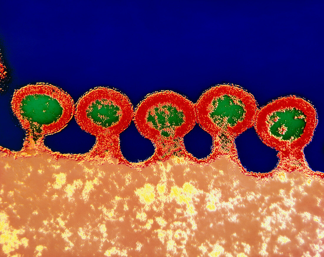 Coloured TEM of HIV viruses budding from host cell
